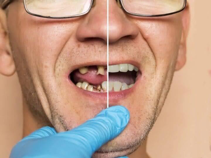 Restorative Dentistry