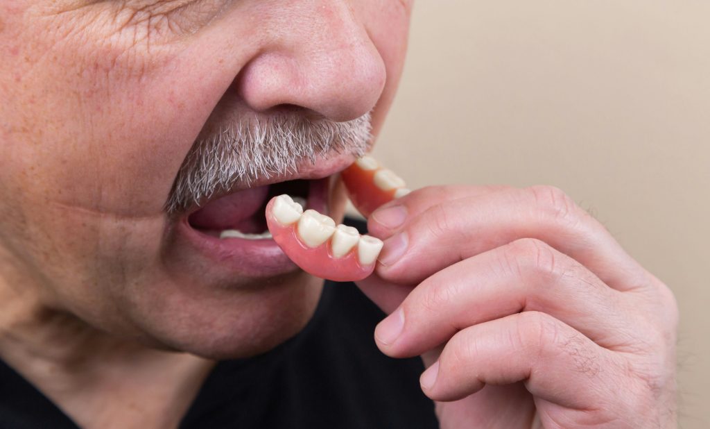 Affordable custom-crafted dentures in Sumter near Charleston, SC.